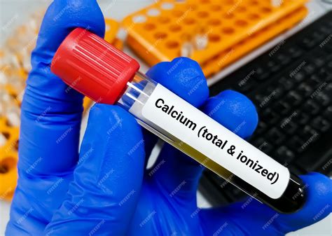 ionized calcium blood test